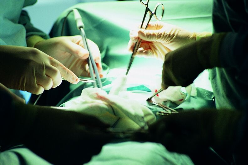 χειρουργική αύξηση του πάχους του πέους